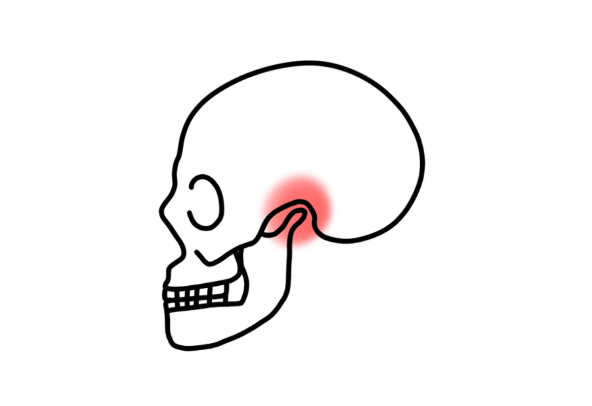 TMJ-Surgery